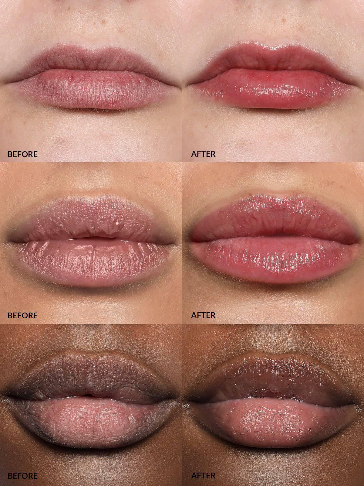 Refy Lip Buff – Dudak Dolgunlaştırıcı - Sneaker Türkiye